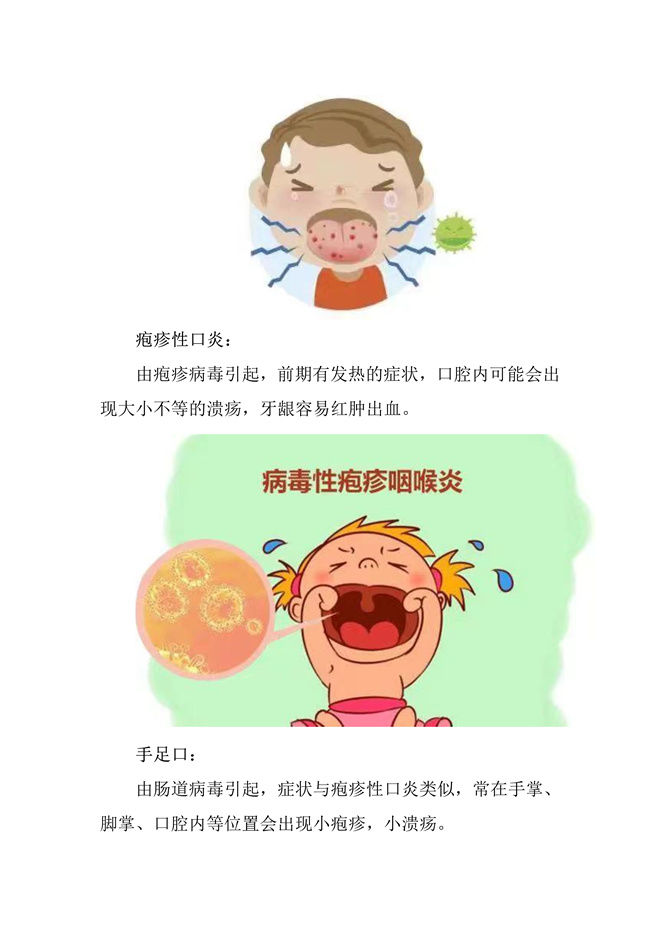 口腔健康——儿童口腔溃疡频频发作？别再怪上火啦_3.jpg